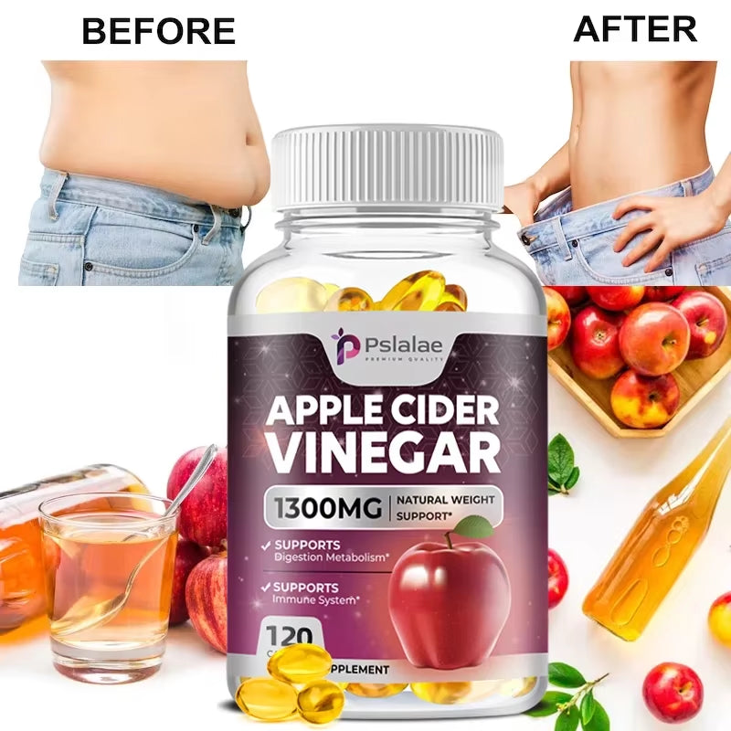 Apple Cider Vinegar Capsules - Detox, Fat Burning, Weight Management, Detox, Appetite Suppressant, Energy Support